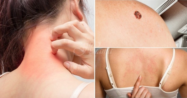 7 опасни изменения по кожата които са първи сигнал за сериозна болест